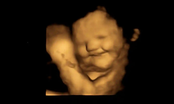 How To Get The Best Ultrasound Photos Of Your Baby